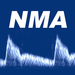 NMA