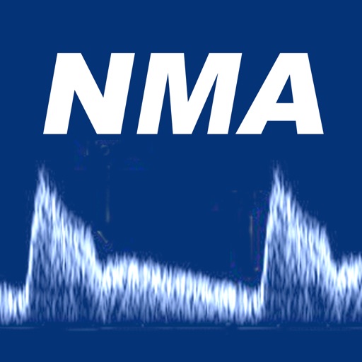 NMA