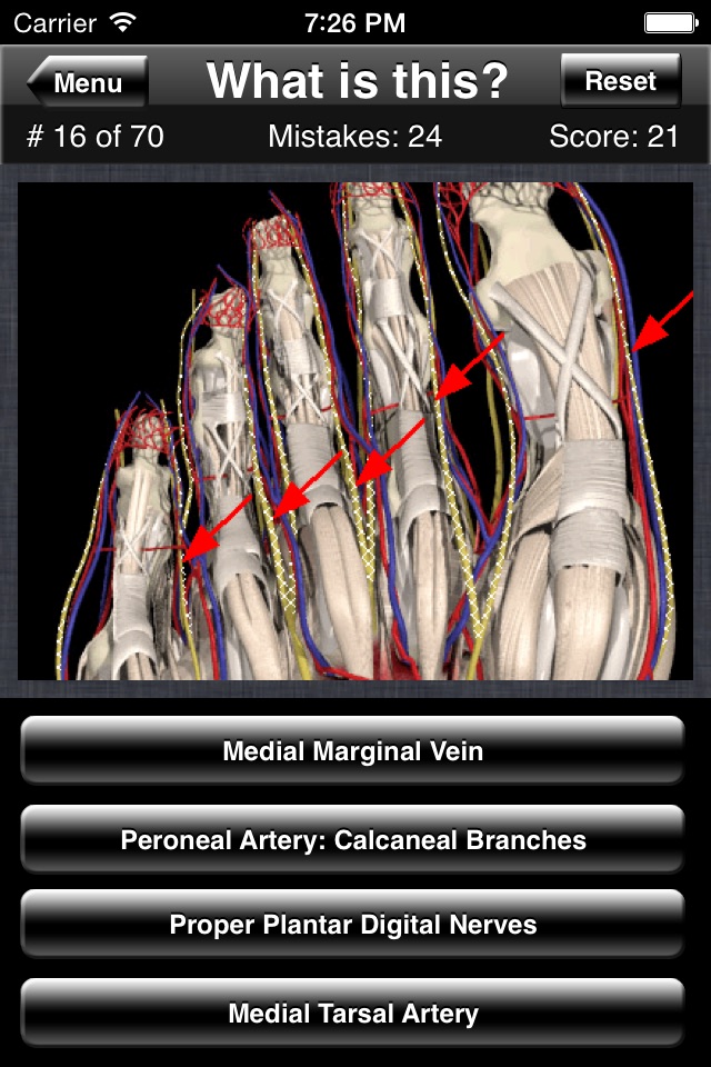 Anatomy Foot Quiz screenshot 2