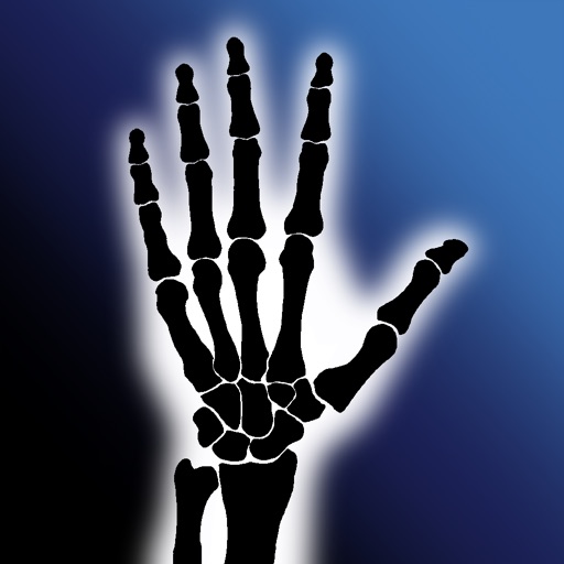 Trigger Finger 3D