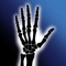 Trigger Finger 3D is your source for everything you need to know about trigger finger