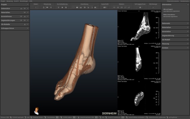 Dornheim DICOM Viewer(圖3)-速報App