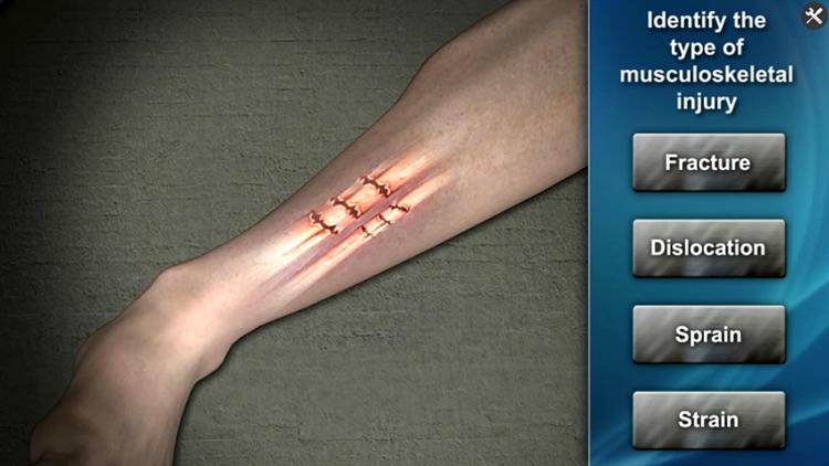 Medrills: Fracture screenshot-3
