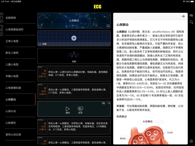 App Store 上的 Ecg Ekg