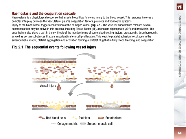 Antithrombotic Therapy.(圖3)-速報App