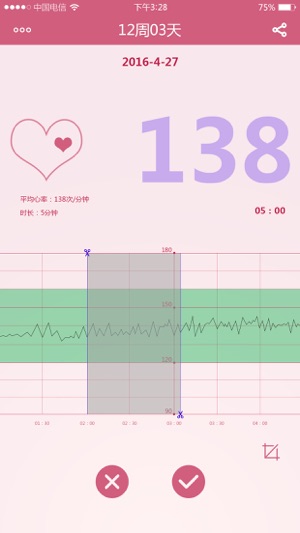 MYWINE fetal DOPPLER(圖3)-速報App