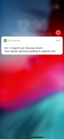 Dexcom G6 app screenshot