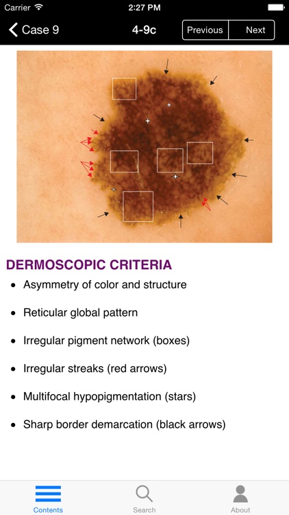 Dermoscopy Self-Assessment screenshot-3