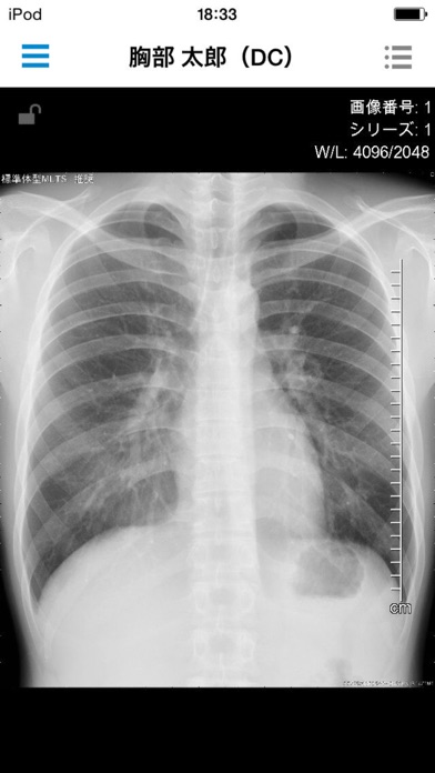 Shadequest Viewair By Fujifilm Medical Solutions Corporation Ios Japan Searchman App Data Information Shadequest Viewair By Fujifilm Medical Solutions Corporation Ios Japan Searchman App Data Information