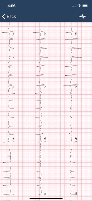 ECG Guide(圖3)-速報App