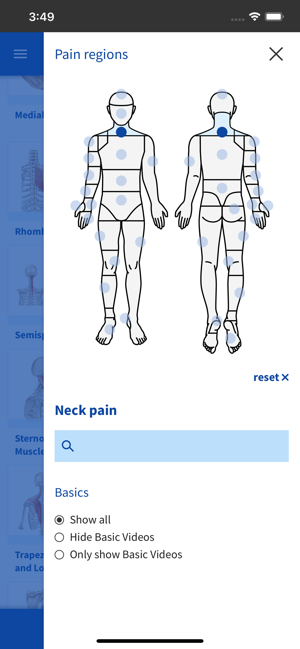 DGSA Dry Needling Videos(圖2)-速報App