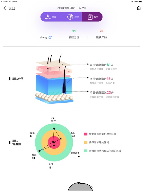 肌肤检测