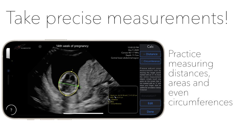 Scanbooster Ultrasound Sim screenshot-6
