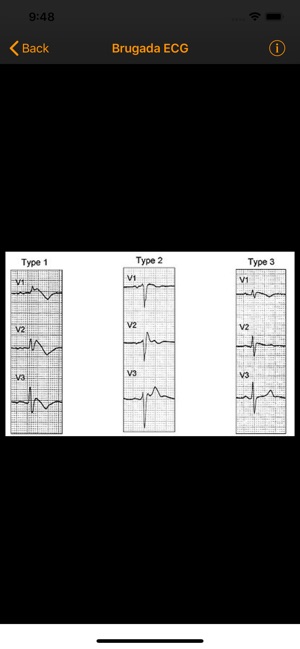 Electrophysiology Tools(圖5)-速報App