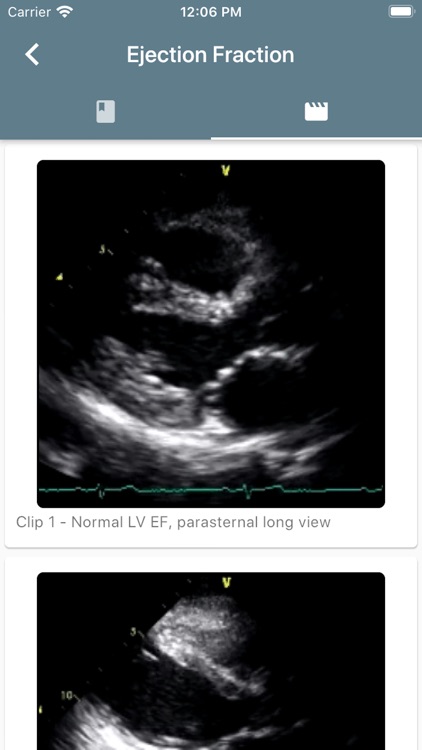 Resuscitation Ultrasound screenshot-6