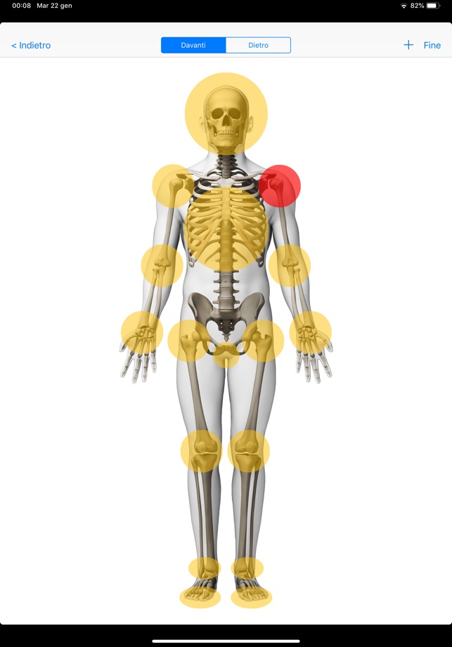 Osteopostural(圖5)-速報App