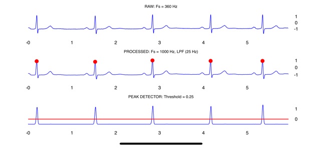 ECG Wiz(圖5)-速報App