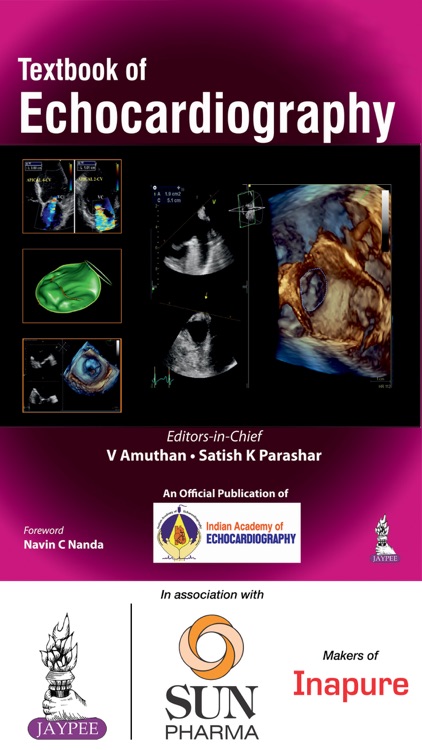 Echocardiography Textbook by Jaypee