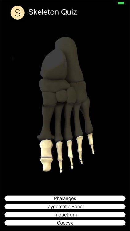 Skeleton Quiz screenshot-4