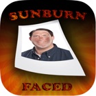 SunburnFaced - The Fake Sun Burn Photo FX Booth