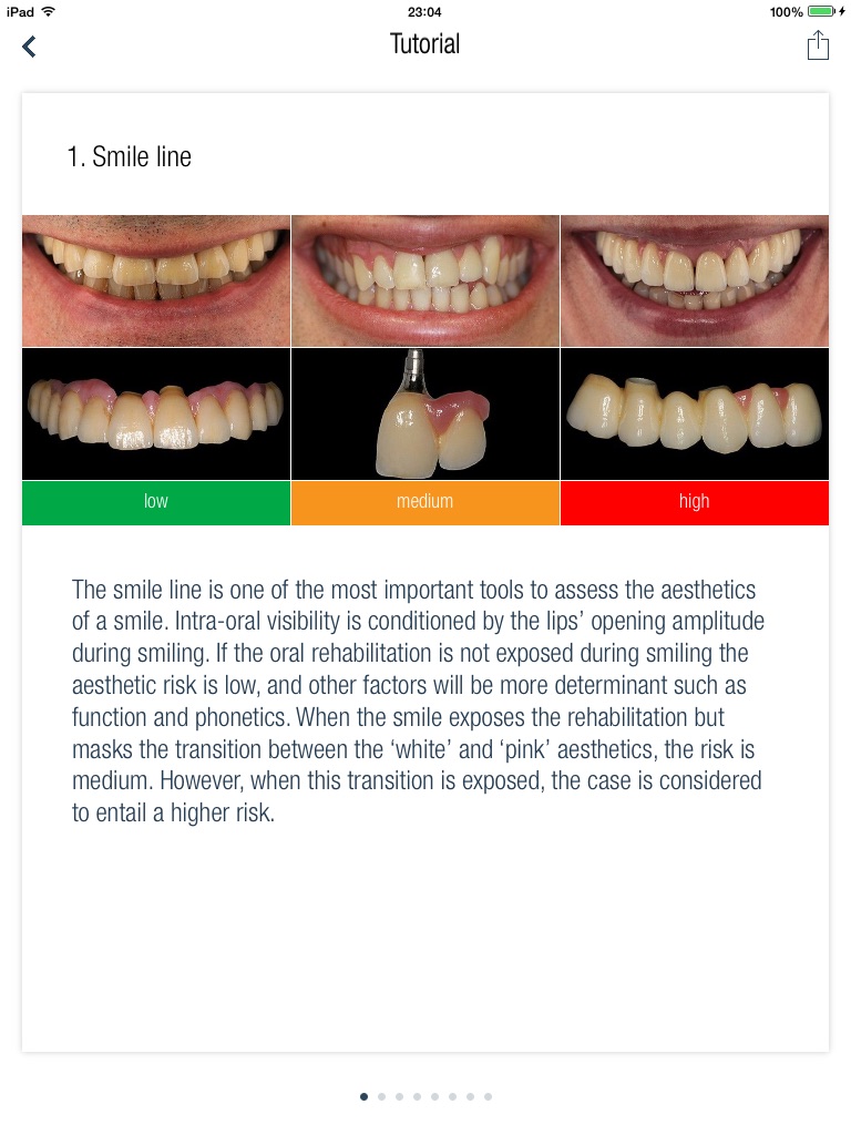 Gingiva-ceramics Assessment screenshot 3