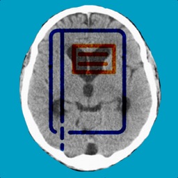 Shunt Diary Headache Tracker