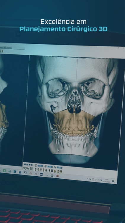 Trion 3D