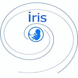 IRIS tool for SGA babies