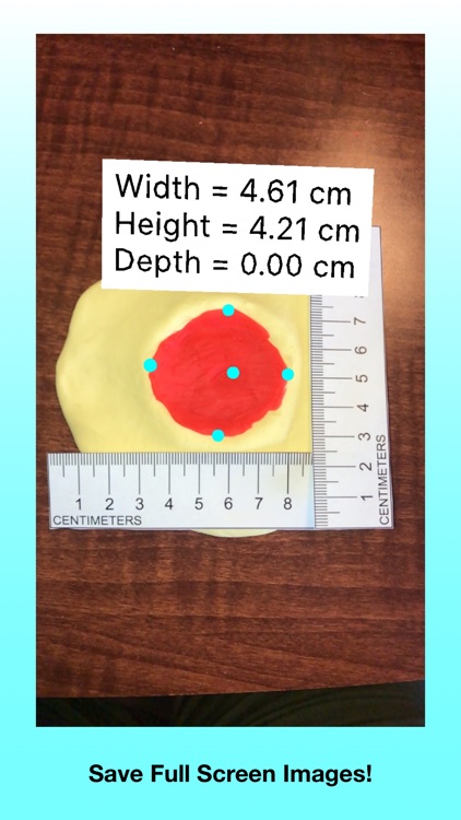 Wound Measurement