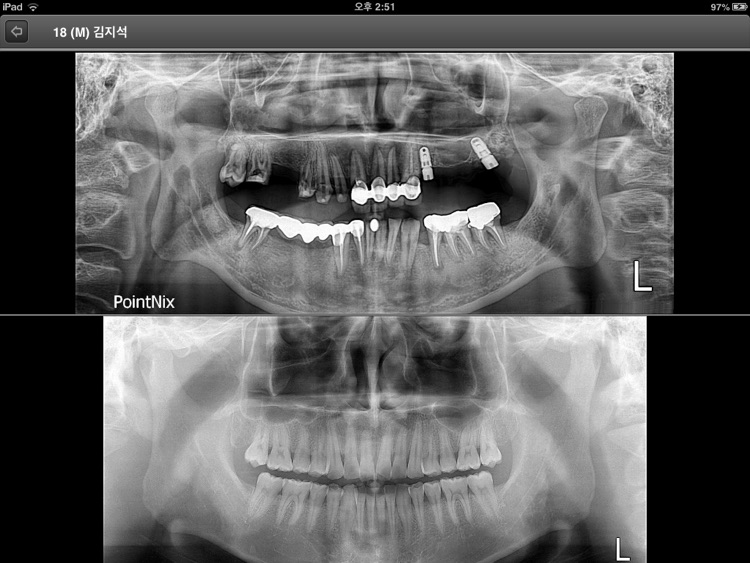 CDX View I