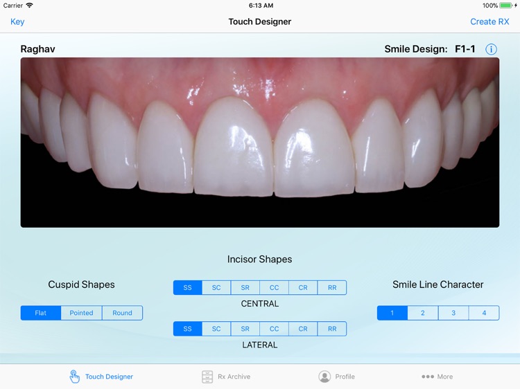 Smile Guide Touch Pro