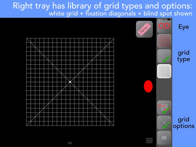 Amsler Grids(圖2)-速報App