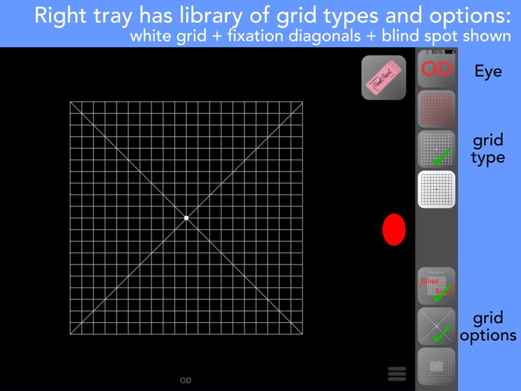 Amsler Grids