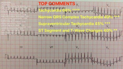 ECG Reader screenshot1