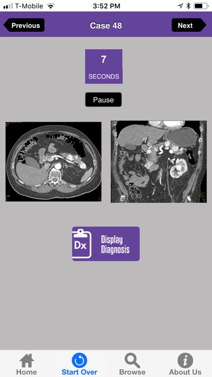 CTisus Challenge: The Pancreas