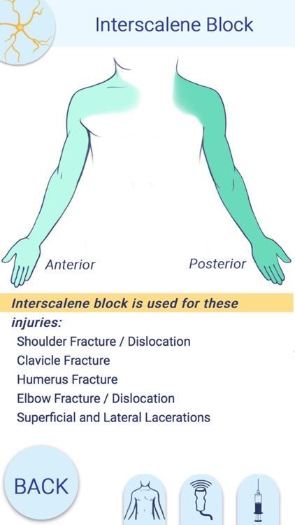 Nerve Block Star App