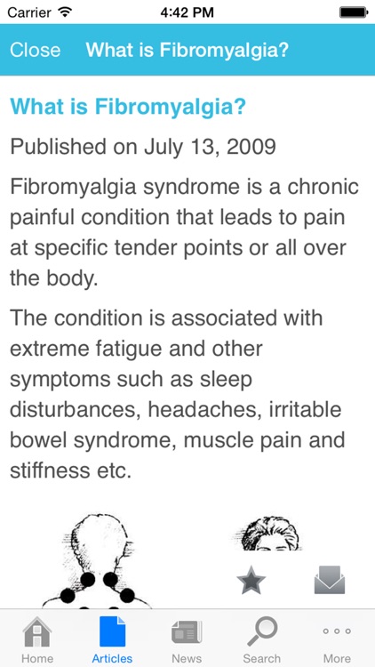 Fibromyalgia by AZoMedical