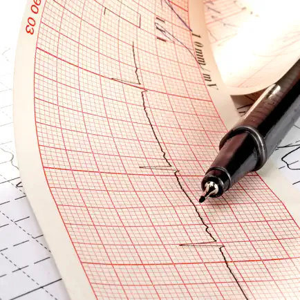 ECG EKG Viewer for Polar H10 Cheats