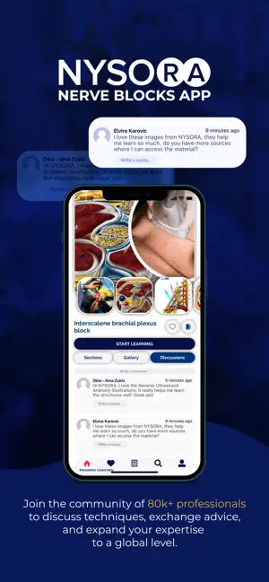 Captura de Pantalla 4 NYSORA Nerve Blocks iphone