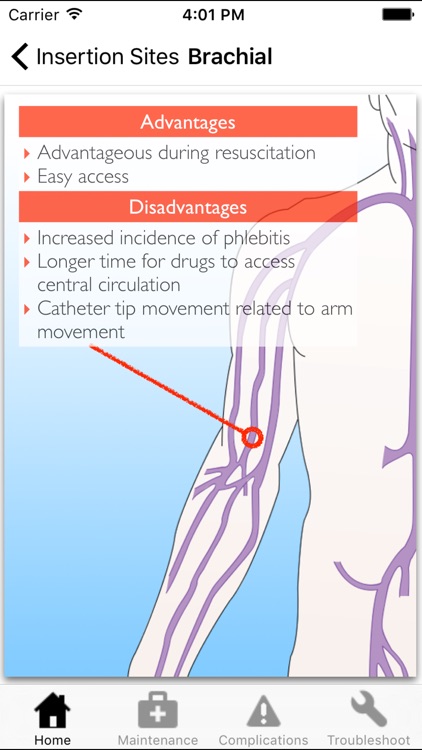 Catheter Pro