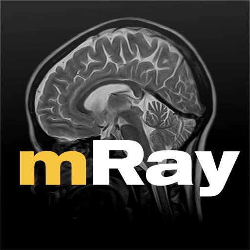 mRay iOS App