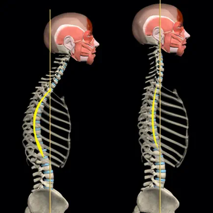 Kyphosis & Rounded Back Cheats