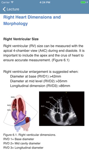 BASIC - Transthoracic Echocard(圖2)-速報App