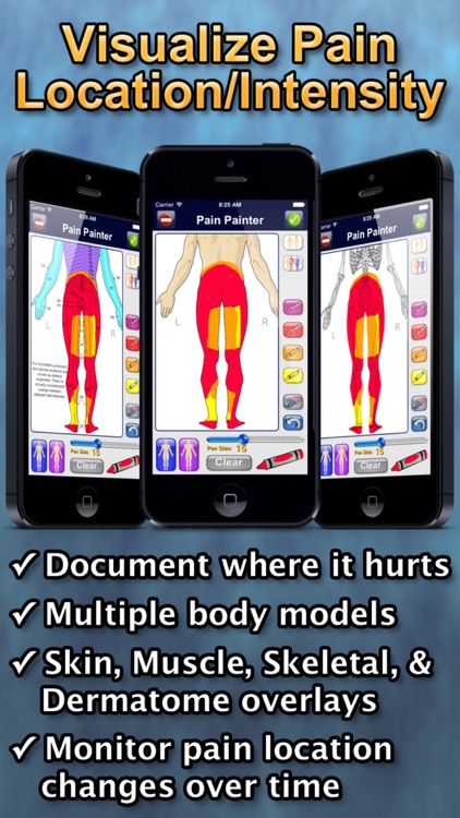 Chronic Pain Tracker