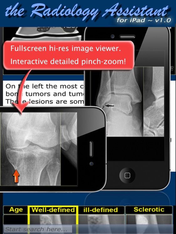 Radiology Assistant for iPad - Imaging Reference screenshot-3