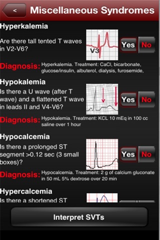 ECG Interpreter screenshot 4