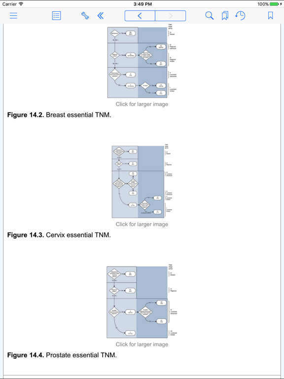 TNM Classification of Malignant Tumours, 8th Edのおすすめ画像3