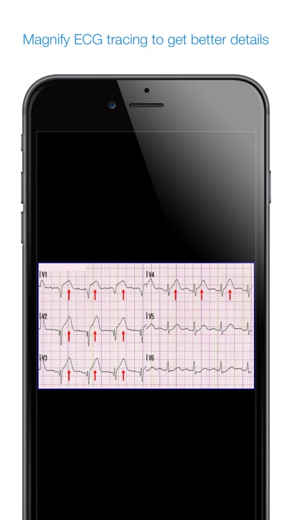 12 Lead ECG Challenge screenshot-3