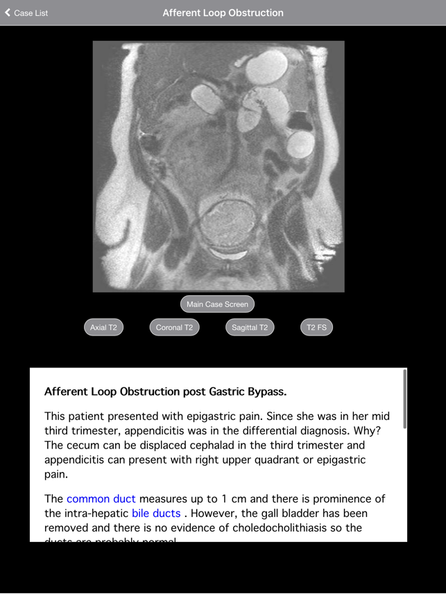 Radiology 2.0: Pregnant Appendicitis(圖4)-速報App