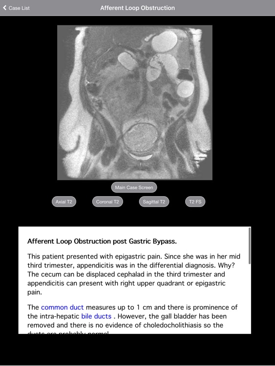 Radiology 2.0: Pregnant Appendicitis screenshot-3